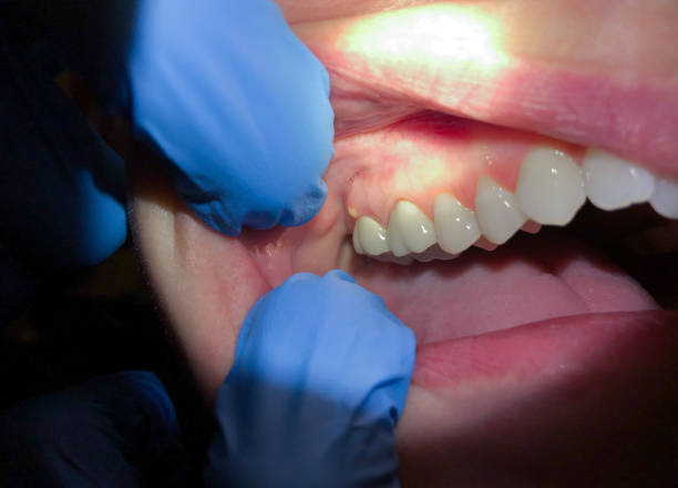 Best Walk-In Emergency Dentist in Man, WV